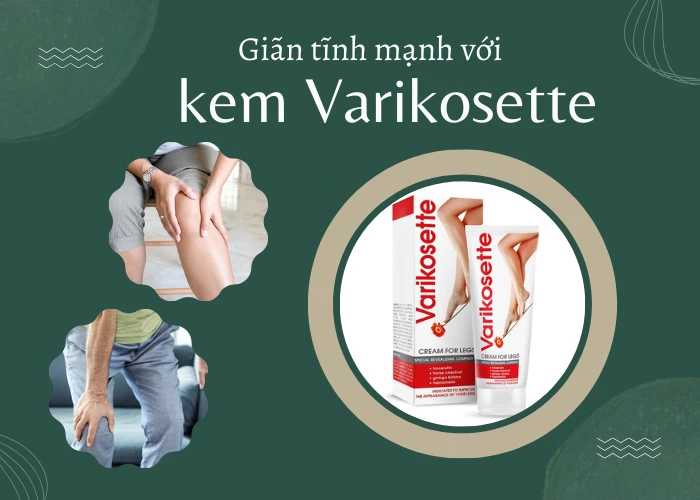 Giảm Giãn Tĩnh Mạch tại Nhà với Kem Varikosette