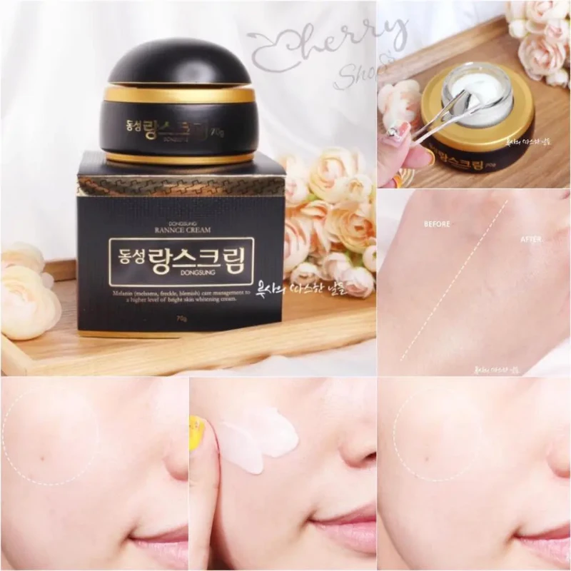 Kem trị nám Dongsung dưỡng da sáng mịn đều màu - ảnh 4