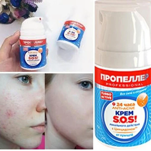 Kem Đặc Trị Mụn Sos của Nga - ảnh 2