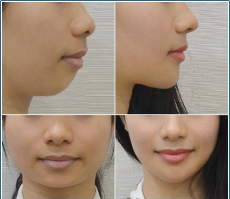 Kem Nâng Cằm Cổ Ngực Novosvit - ảnh 2