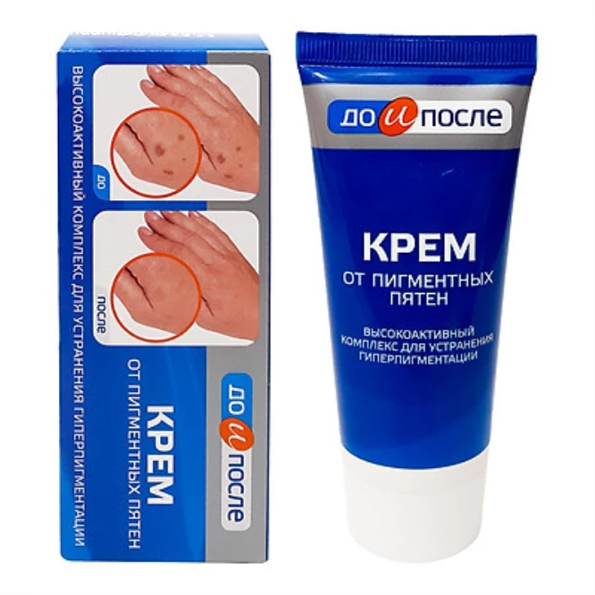 Kem Tay Kpem Trị Đồi Mồi , Vết Nám , Sạm Đốm Nâu Da Tay 50ml - ảnh 2
