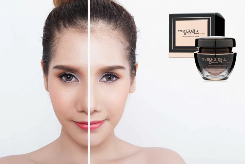 Kem Trị Nám Dongsung Rannce Cream Hàn Quốc 50g - ảnh 2
