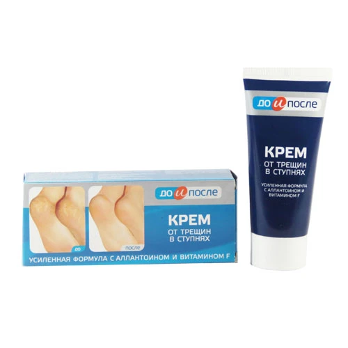 Kem Trị Nứt Gót Chân Kpem Chính Hãng Nga - ảnh 1