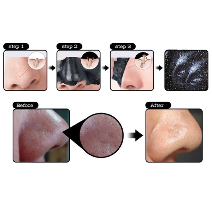 Mặt Nạ Lột Mụn Đầu Đen Princess Mask Nga Chính Hãng - ảnh 3