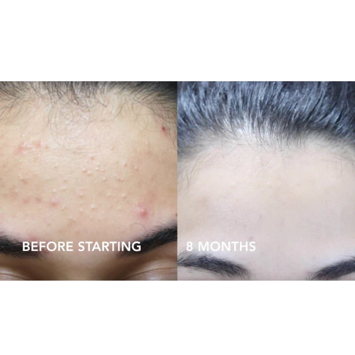 Sữa Rửa Mặt Cetaphil Gentle Skin Cleanser 125ml - ảnh 2