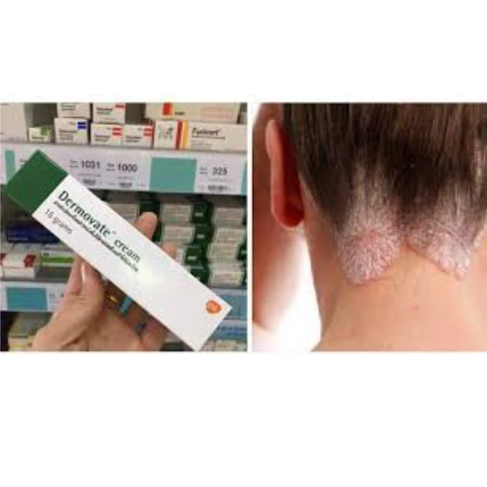 Thuốc Trị Viêm Da Dermovate Cream 15g Thái Lan - ảnh 3