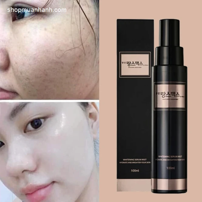 Tinh Chất Trắng Da Trị Nám Dongsung Whitening Serum Mist - ảnh 2