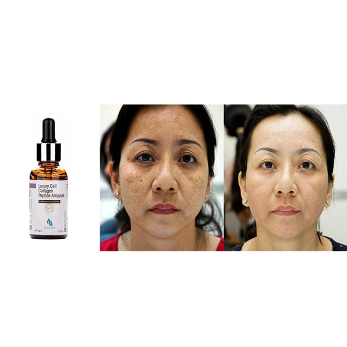 Tinh Chất Trị Nám Cao Cấp Dew And Dew Luxury Cell Collagen Peptide 30ml - ảnh 4
