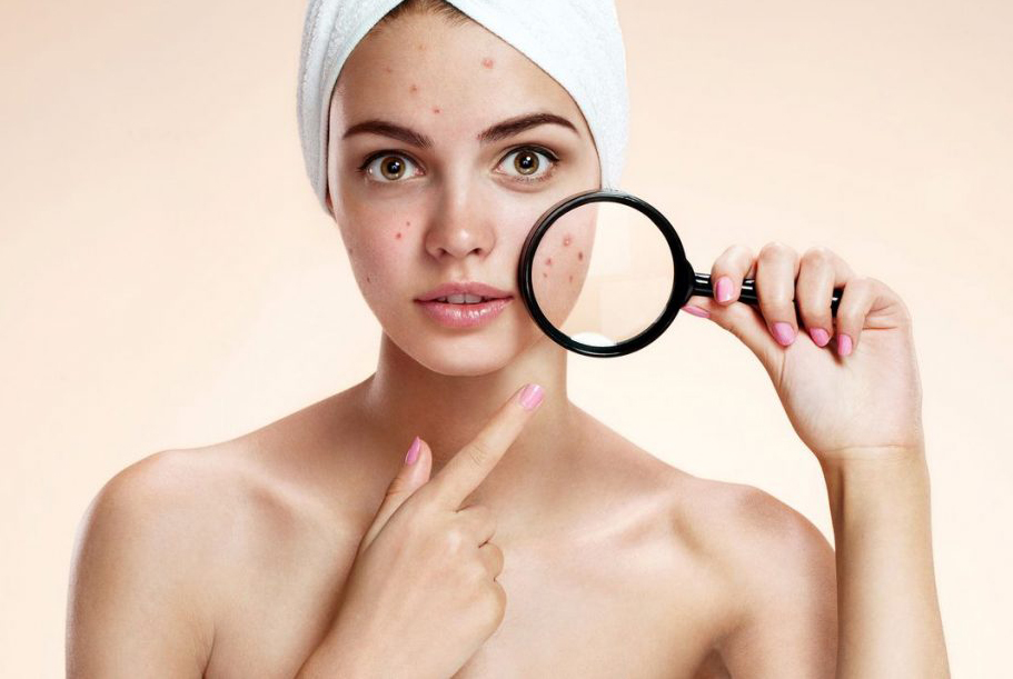 5 thành phần chăm sóc da nên tránh đối với các cô nàng da khô cam-nang-cham-soc-da - 1