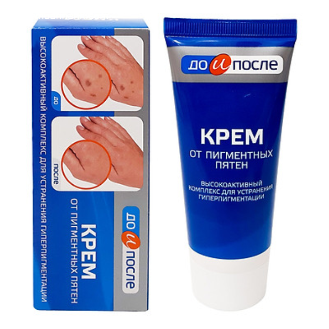 Kem Tay Kpem Trị Đồi Mồi , Vết Nám , Sạm Đốm Nâu Da Tay 50ml-1