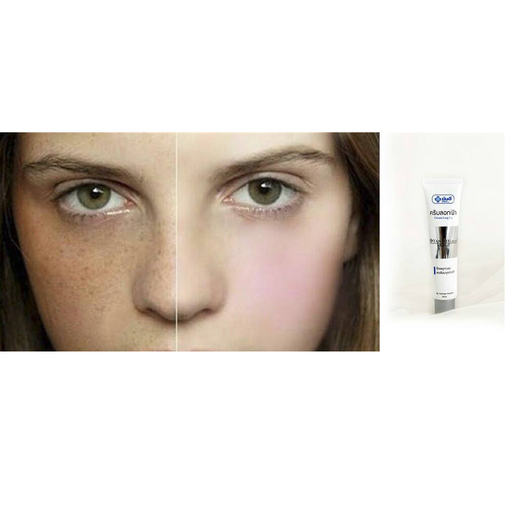 Kem Đặc Trị Nám Cream CCM Thái Lan-2