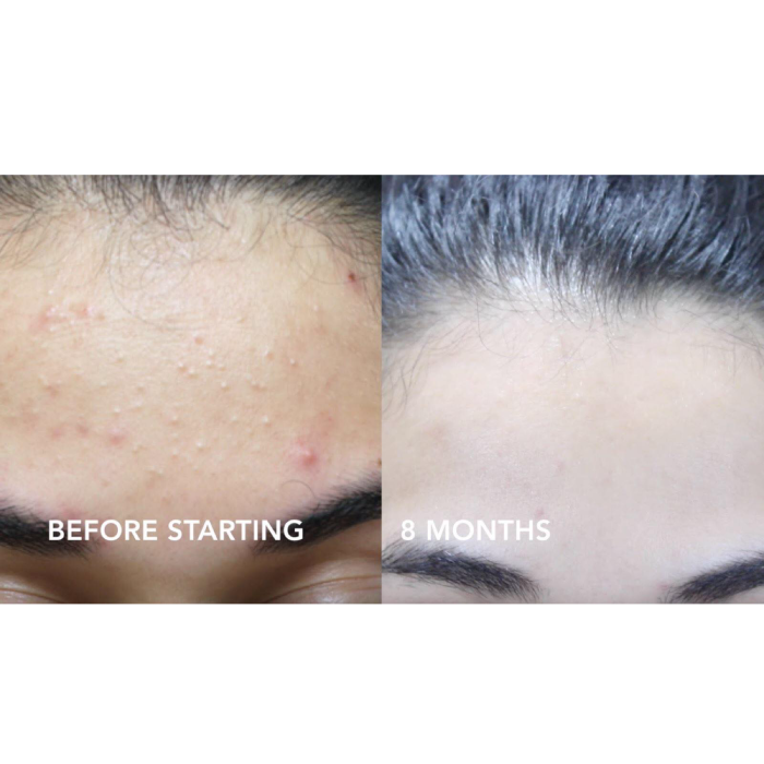 Sữa Rửa Mặt Cetaphil Gentle Skin Cleanser 125ml-1