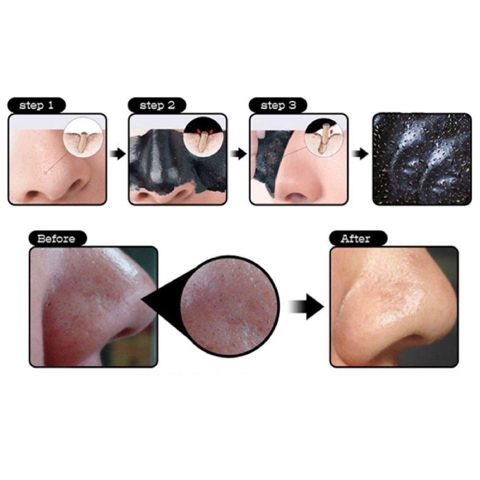 Mặt Nạ Lột Mụn Đầu Đen Princess Mask Nga Chính Hãng-2