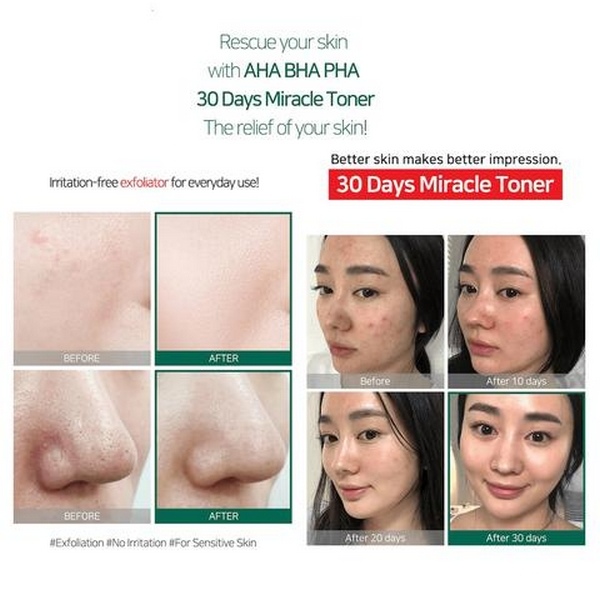 Nước Hoa Hồng Trị Mụn Tái Tạo Da Some By Mi AHA - BHA - PHA 30 Day Miracles-1