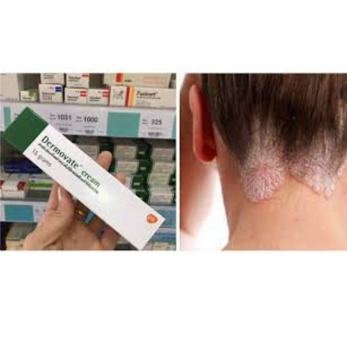 Thuốc Trị Viêm Da Dermovate Cream 15g Thái Lan-2