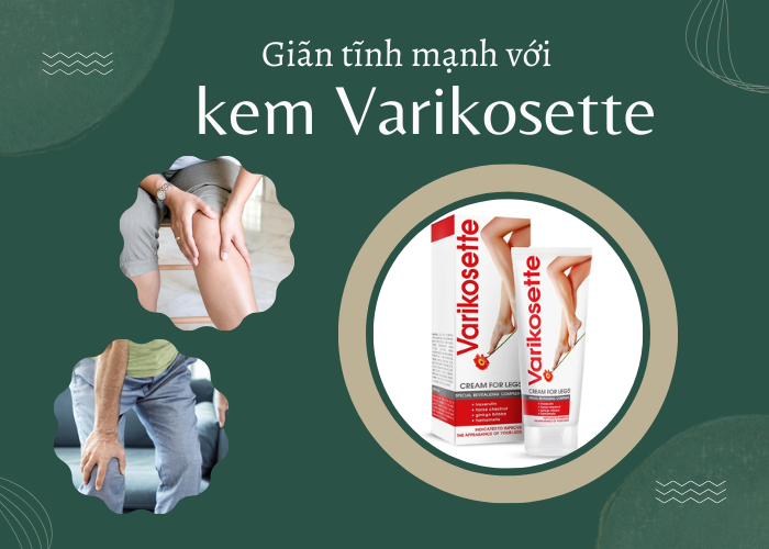 Giảm giãn tĩnh mạch tại nhà với kem Varikosette