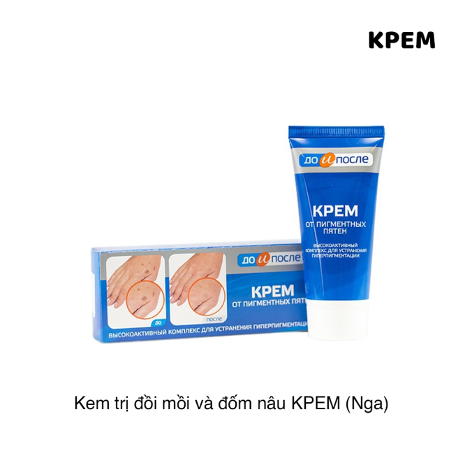 Kem Tay Kpem Trị Đồi Mồi , Vết Nám , Sạm Đốm Nâu Da Tay 50ml Dưỡng Da Mặt-1