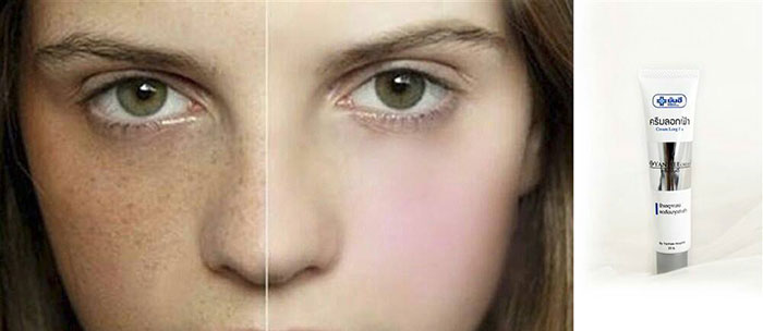 Kem Đặc Trị Nám Cream CCM Thái Lan Kem Trị Nám-1