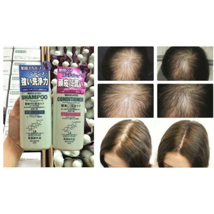 Dầu Gội Kaminomoto Kích Thích Mọc Tóc Nhật Bản-2