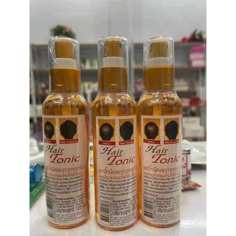 Xịt mọc tóc dài , ngăn ngừa hói đầu Genive Hair tonic - Thái lan-1